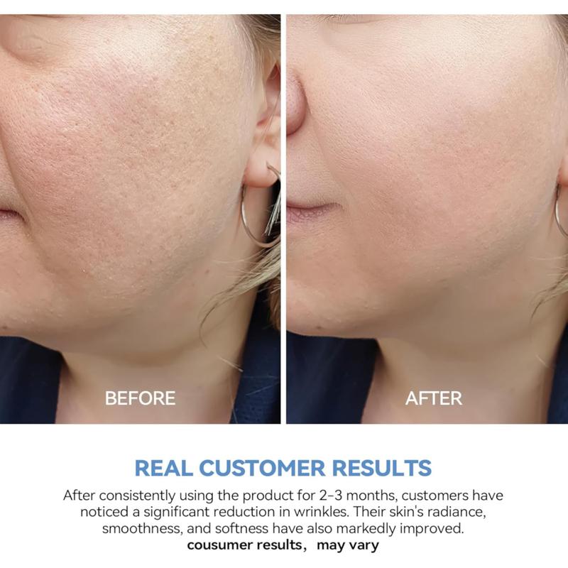 Wnp Hyaluronic Acid Tubes, Wnp 3% Hyaluronic Acid Serum Ultra-Hydrating Vials, Organic Hydrating Hyaluronic Acid Serum for Face Korean, Wnp Ultra Hydrating Serum Skincare Essence