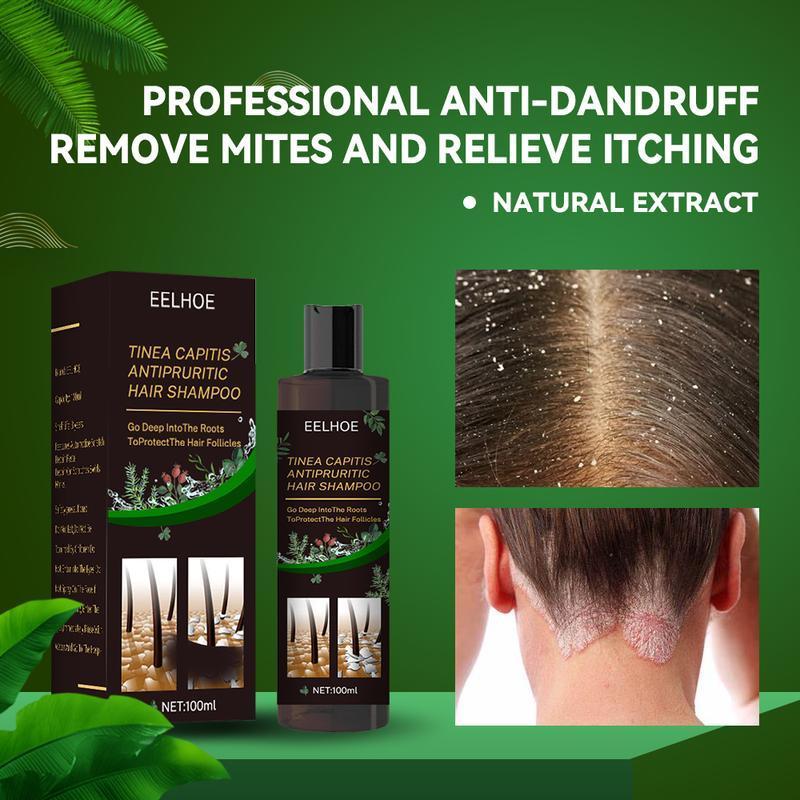 Tinea Capitis Antipruritic Hair Shampoo, Anti-Drop Refreshing Oil Control Hair Conditioner Anti-Dandruff Anti-Itch Shampoo Haircare Aloe Haircare Aloe black  shampoo