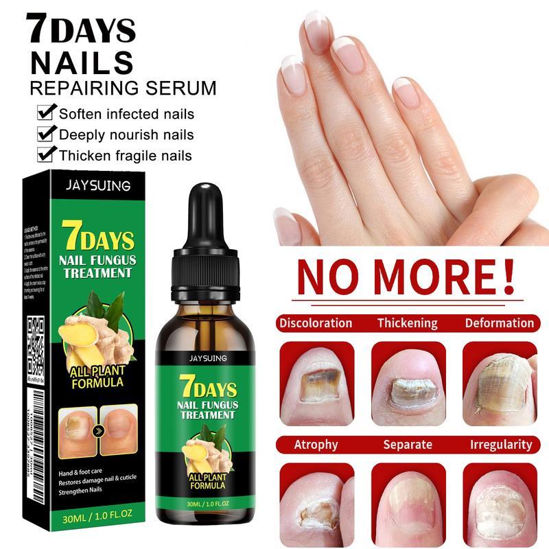 Multi-Purpose Nail Repair, Nail Solution for Discolored and Damaged Nails, 1.0fl oz